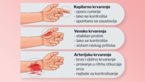 Извор:Eklinika.telegraf.rs